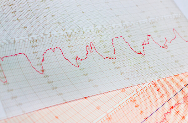 2_不妊治療_タイミング
